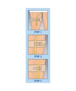 Cathéter/sangle de tube Urocare standard 18" - Convient à 9"-30" - 1 de chaque