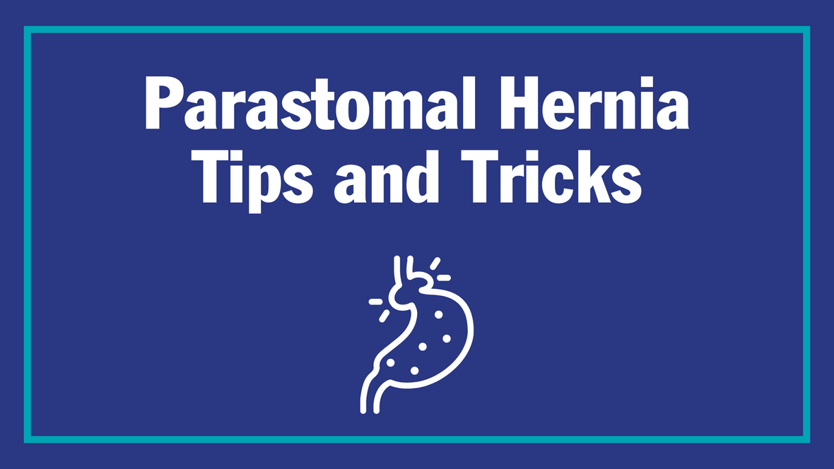 Parastomal Hernia Tips and Tricks