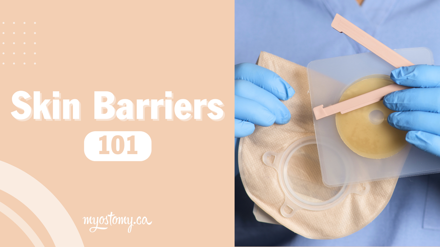 Skin Barriers Guide blog banner for ostomy, featuring gloved hands holding an ostomy pouch and skin barrier.