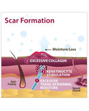 Biodermis Epi-Derm Silicone Gel C-Strip 1.25"x5.75" - Clear Gel (5 Strip per Package)-2