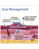 Biodermis Epi-Derm Silicone Gel C-Strip 1.25"x5.75" - Clear Gel (5 Strip per Package)-3