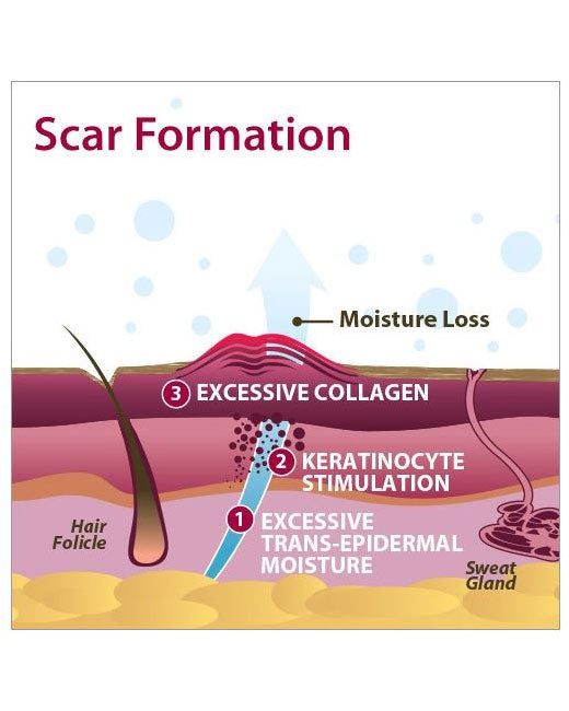 Biodermis Epi-Derm Epi-Tabs Circle .75"x.75" - Clear Gel (6 per Package)