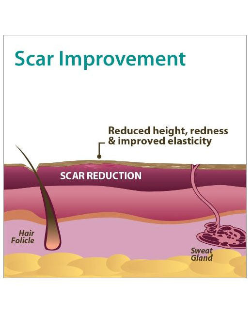 Biodermis Epi-Derm Epi-Tabs Circle .75"x.75" - Clear Gel 30 per Package)