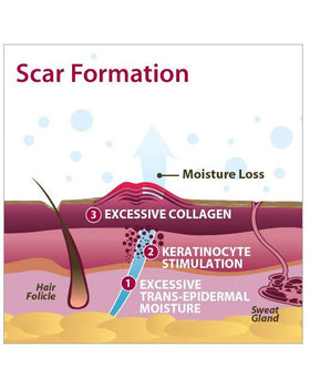 Biodermis Epi-Derm Silicone Gel Long Strip 1.4"x11.5" - Clear Gel (1 Pair per Package) - 0
