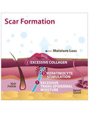 Biodermis Epi-Derm Silicone Gel Long Strip 1.4"x11.5" - Clear Gel (5 Pair per Package)-2