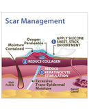 Biodermis Epi-Derm Silicone Gel Long Strip 1.4"x11.5" - Clear Gel (1 Pair per Package)-3