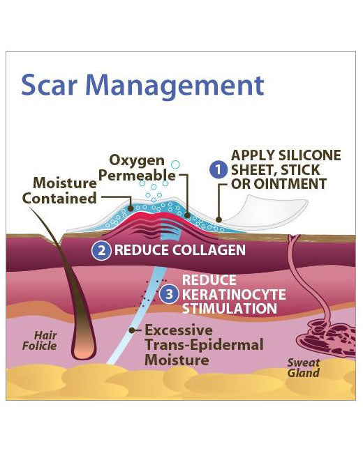 Biodermis Epi-Derm Silicone Gel Standard Sheet 4.7" x 5.7" - Clear Gel - 5 sheets per package