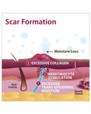 Biodermis Pro-Sil SPF  Silicone Scar Stick 4.25gm Tube - 1 each-4