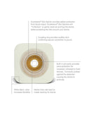 Convatec Natura Durahesive Moldable Skin Barrier - 10 per box, 33MM - 45MM (1 1/4" - 1 3/4"), RED - HYDROCOLLOID COLLAR-2