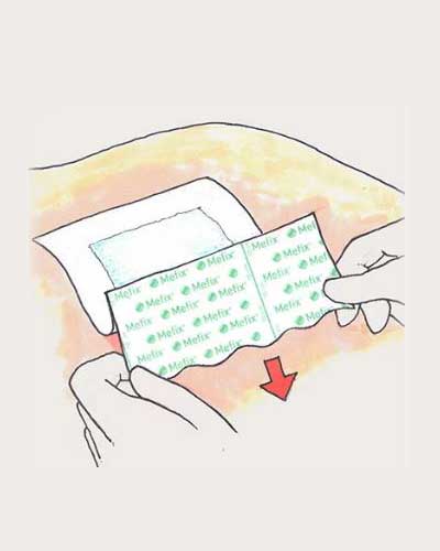 Mefix Self-adhesive Fabric | Medical Dressings